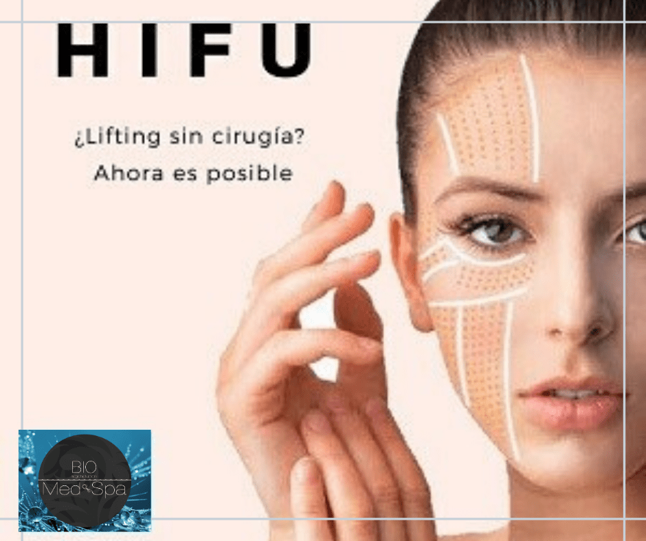 HIFU